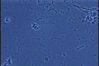 位相差顕微鏡によるプラーク内の細菌像３