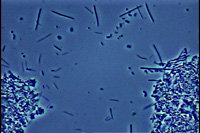 位相差顕微鏡によるプラーク内の細菌像２
