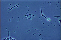 位相差顕微鏡によるプラーク内の細菌像１