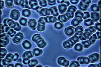 位相差顕微鏡による血液像４